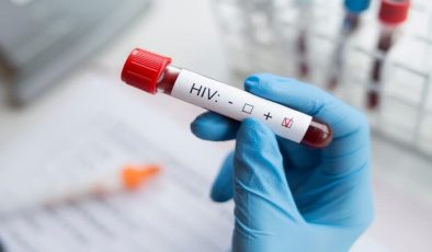 HIV Nedir? Bulaş Yolları Nasıl Gerçekleşir?